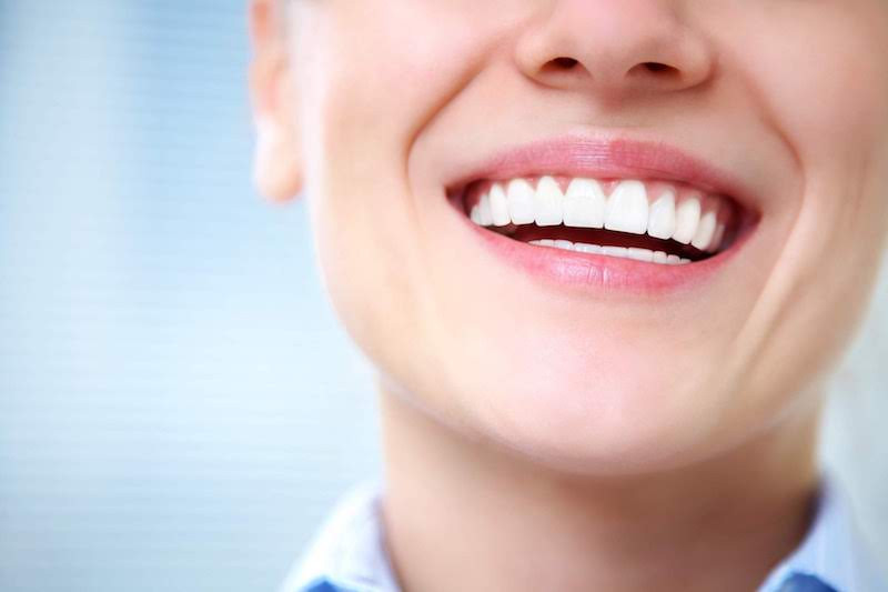 歯医者のホワイトニングは価格が高い？？